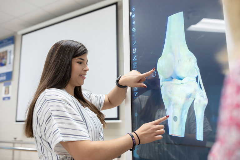 Student pointing at an x-ray of a joint